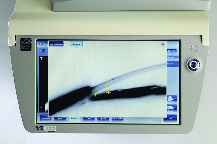 Прибор офтальмологический многофункциональный Visionix VX120+ Dry Eye
